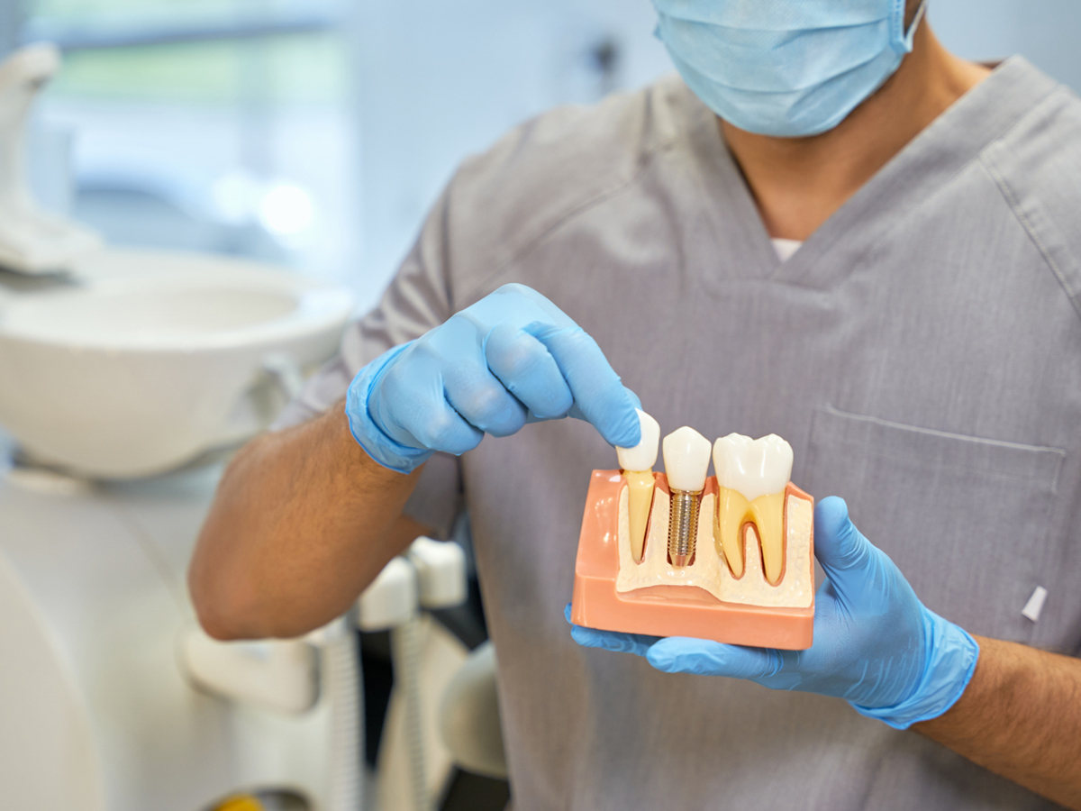 dental implants King Street Dentistry step-by-step process