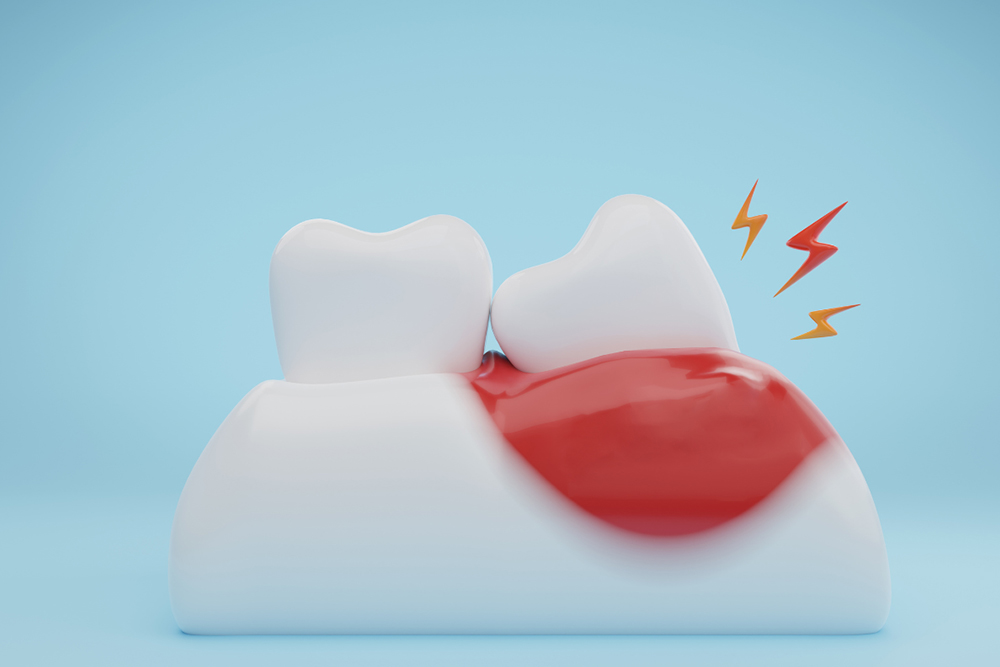 dentist near me King Street Dentistry swollen gums urgent care