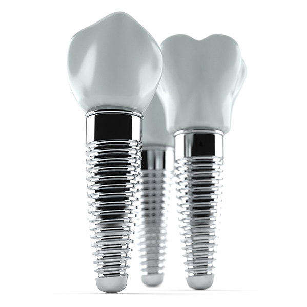 dental-implants